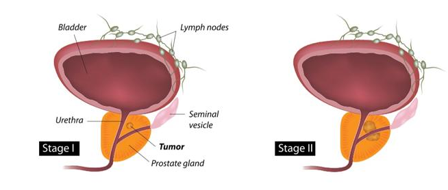 Initiation of the cancer